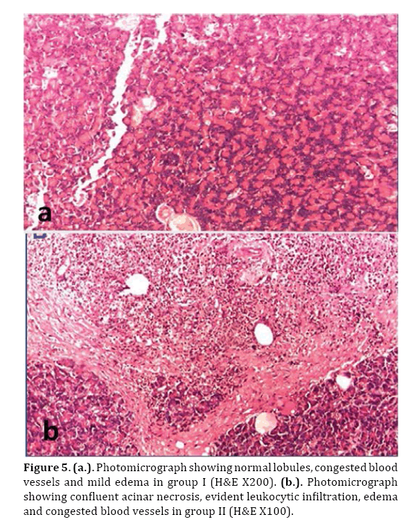 Pancreas-normal-lobules-congested-blood