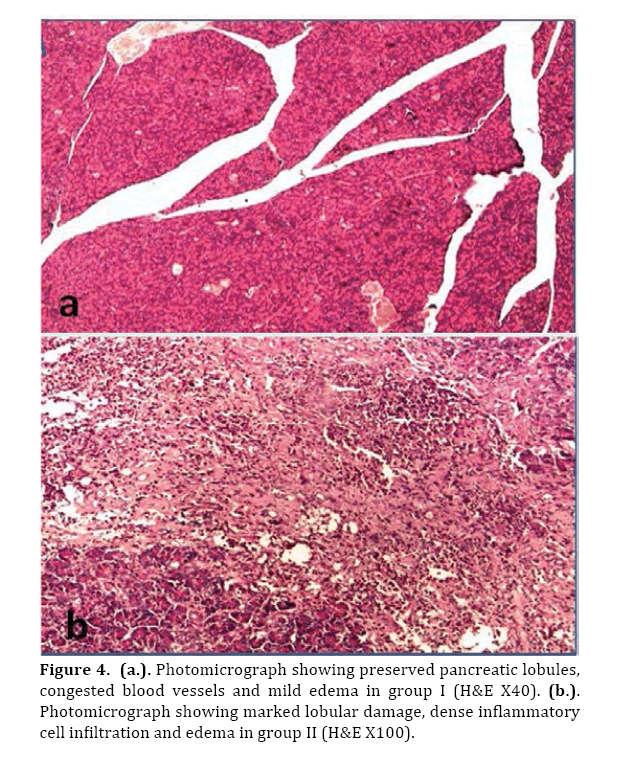 Pancreas-preserved-pancreatic-lobules