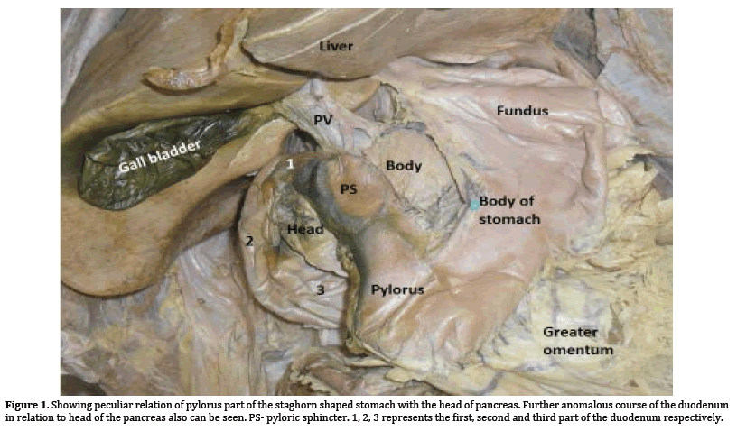 Pancreas-pylorus-part