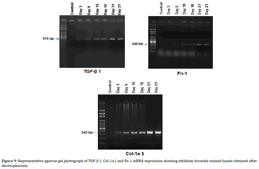 Pancreas-representative-agarose