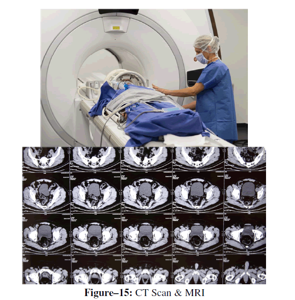 advanced-drug-delivery-ct-scan