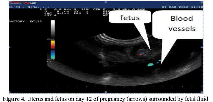 advanced-drug-delivery-fetus