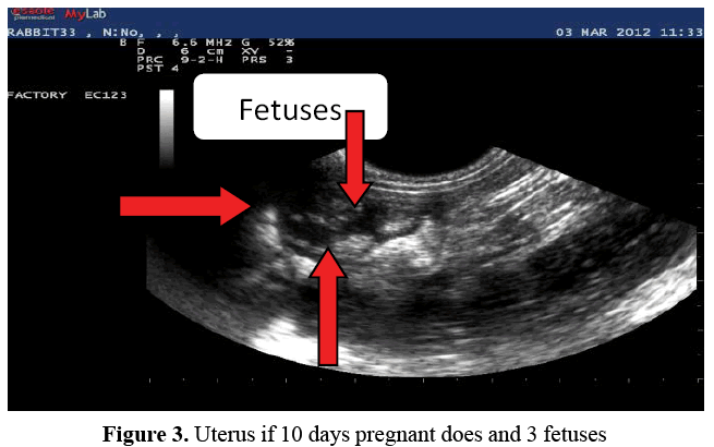 advanced-drug-delivery-fetuses