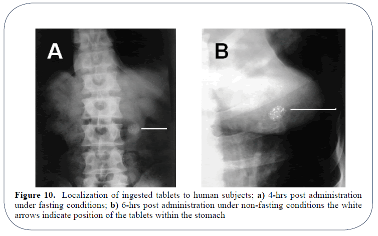 advanced-drug-delivery-localization-ingested-tablets