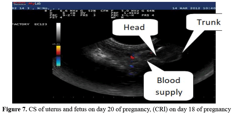 advanced-drug-delivery-uterus