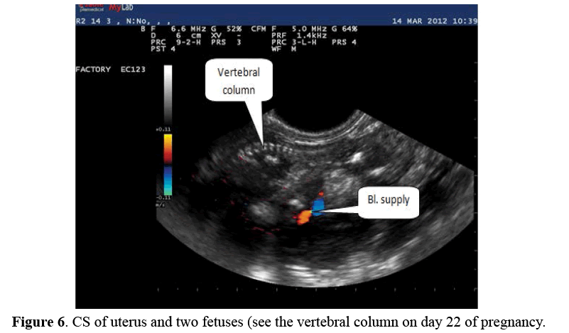 advanced-drug-delivery-vertebral