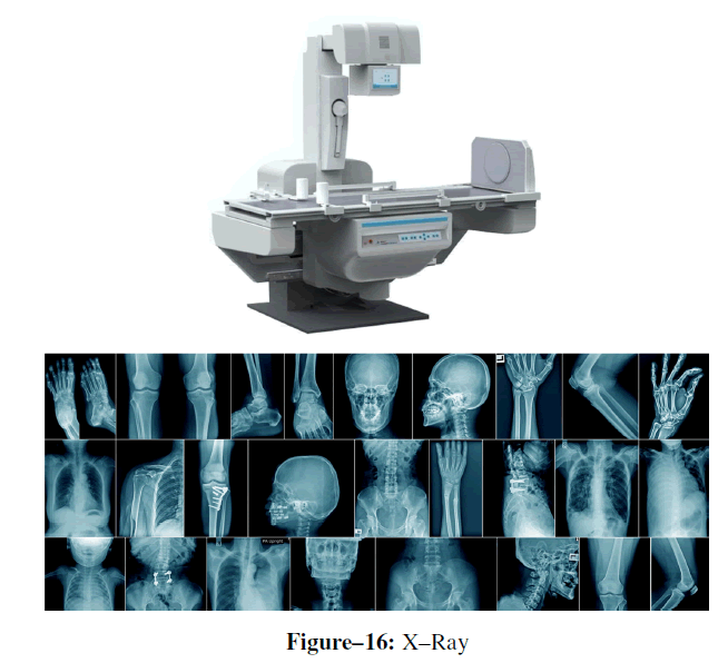 advanced-drug-delivery-x-ray