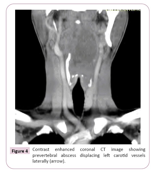 advances-in-applied-science-research-coronal