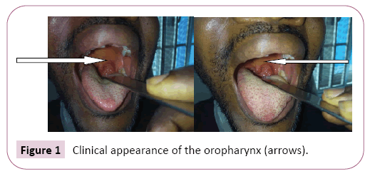 advances-in-applied-science-research-oropharynx