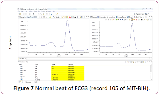 applied-science-research-review-Normal-beat