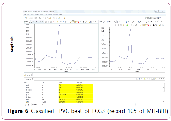 applied-science-research-review-beat-ECG3