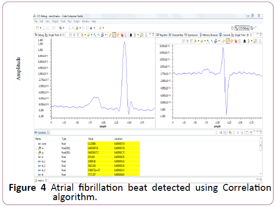 applied-science-research-review-beat-detected