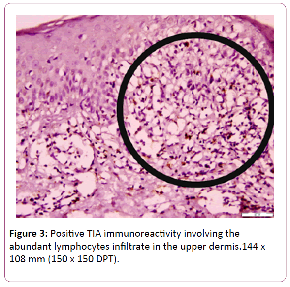 applied-science-research-review-upper-dermis