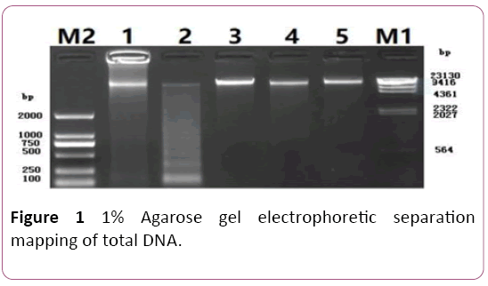 biochem-molbio-Agarose-gel