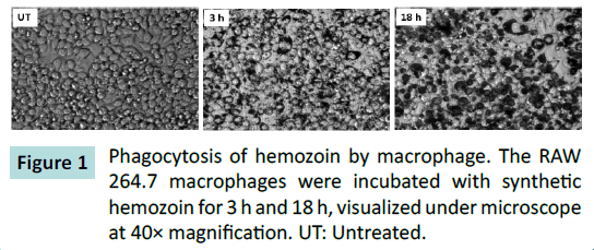 biochem-molbio-hemozoin-macrophage