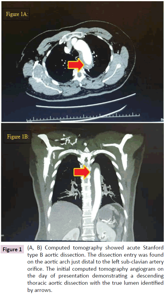 biomarkers-Computed-tomography