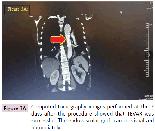 biomarkers-Computed-tomography-images