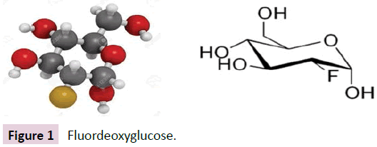 biomarkers-Fluordeoxyglucose