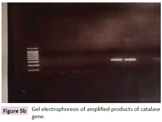 biomarkers-Gel-electrophoresis