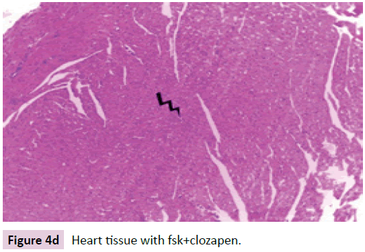 biomarkers-Heart-tissue