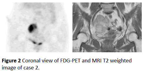 biomarkers-MRI-T2-weighted-image