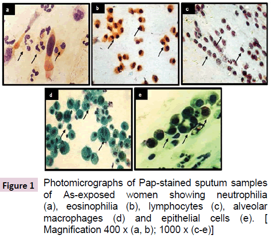 biomarkers-Pap-stained-sputum-samples