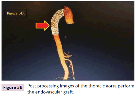 biomarkers-Post-processing-images