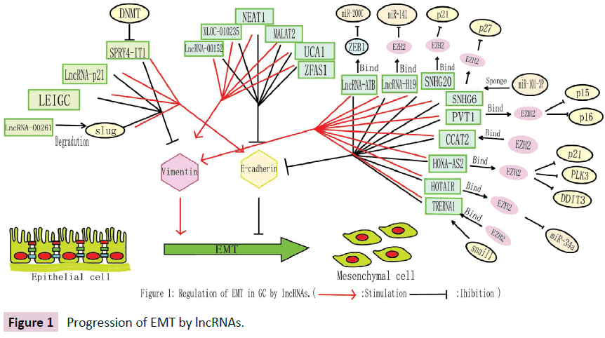 biomarkers-Progression-EMT-lncRNAs