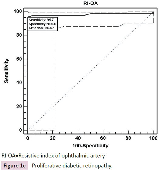 biomarkers-Proliferative-diabetic-retinopathy