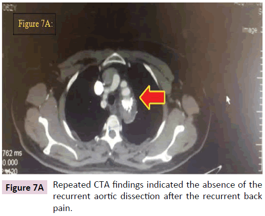 biomarkers-Repeated-CTA-findings