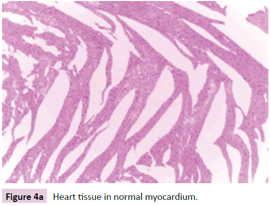 biomarkers-normal-myocardium