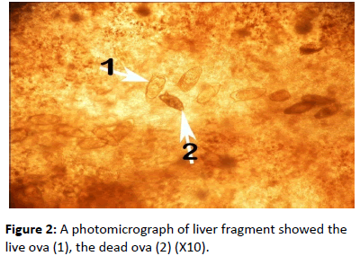 biomarkers-photomicrograph-liver-fragment