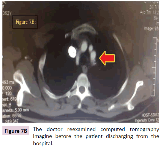 biomarkers-reexamined-computed-tomography