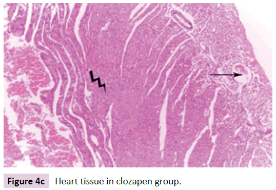 biomarkers-tissue-clozapen-group