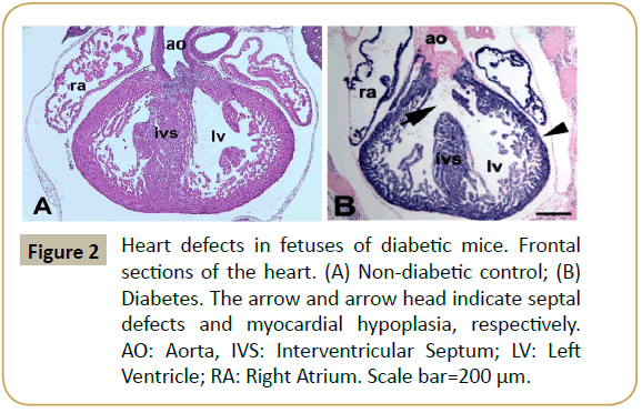 biomedicine-Heart-defects