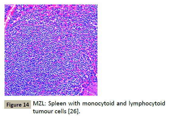 biomedicine-Spleen-monocytoid
