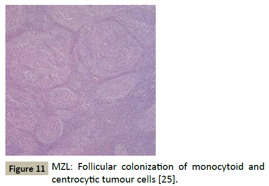 biomedicine-colonization-monocytoid