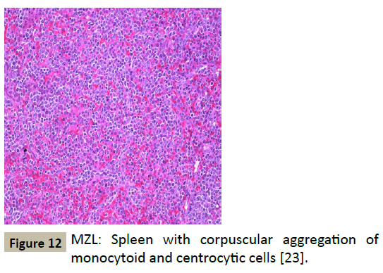 biomedicine-corpuscular-aggregation