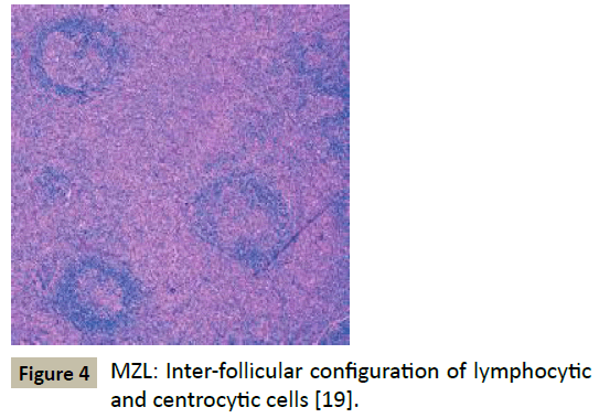 biomedicine-lymphocytic-centrocytic