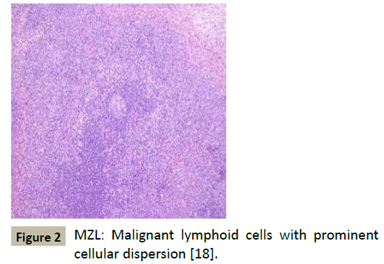 biomedicine-lymphoid-cells