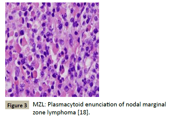 biomedicine-nodal-marginal