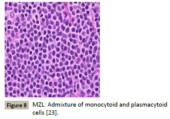 biomedicine-plasmacytoid