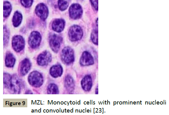 biomedicine-prominent-nucleoli