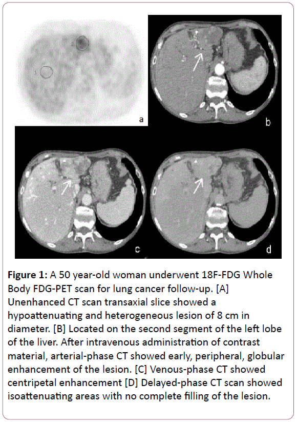 british-journal-CT-scan-transaxial