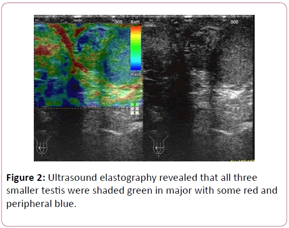 british-journal-of-research-Ultrasound-elastography