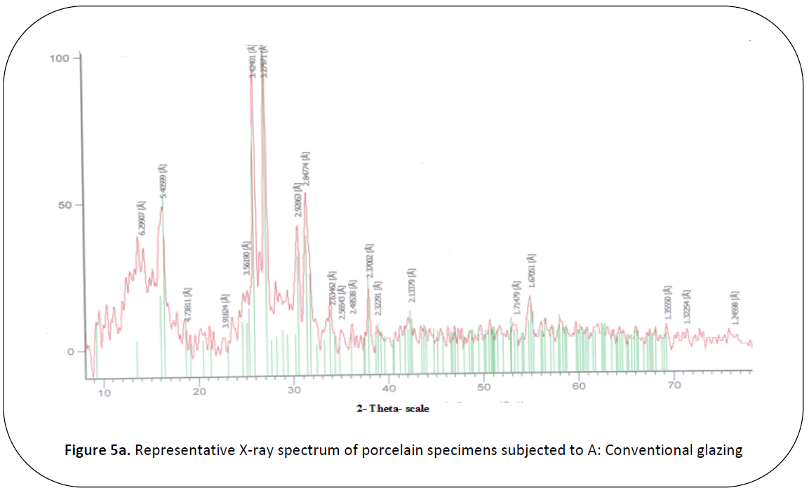 british-journal-of-research-X-ray-spectrum