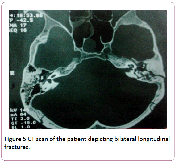 british-journal-of-research-depicting-bilateral