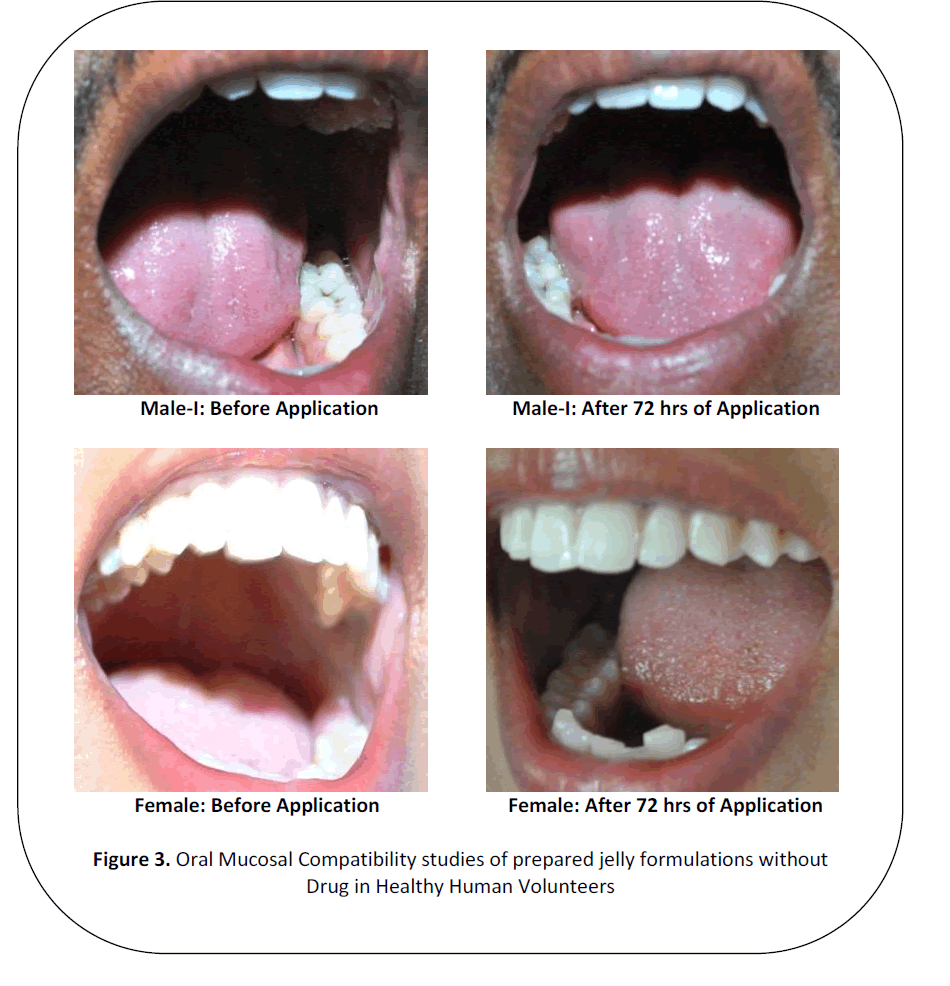 british-journal-research-Oral-Mucosal-Compatibility