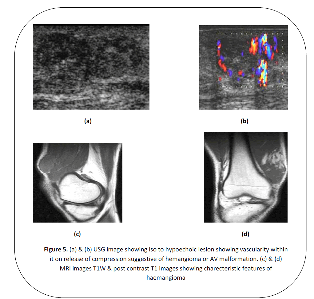 british-journal-research-hypoechoic-lesion