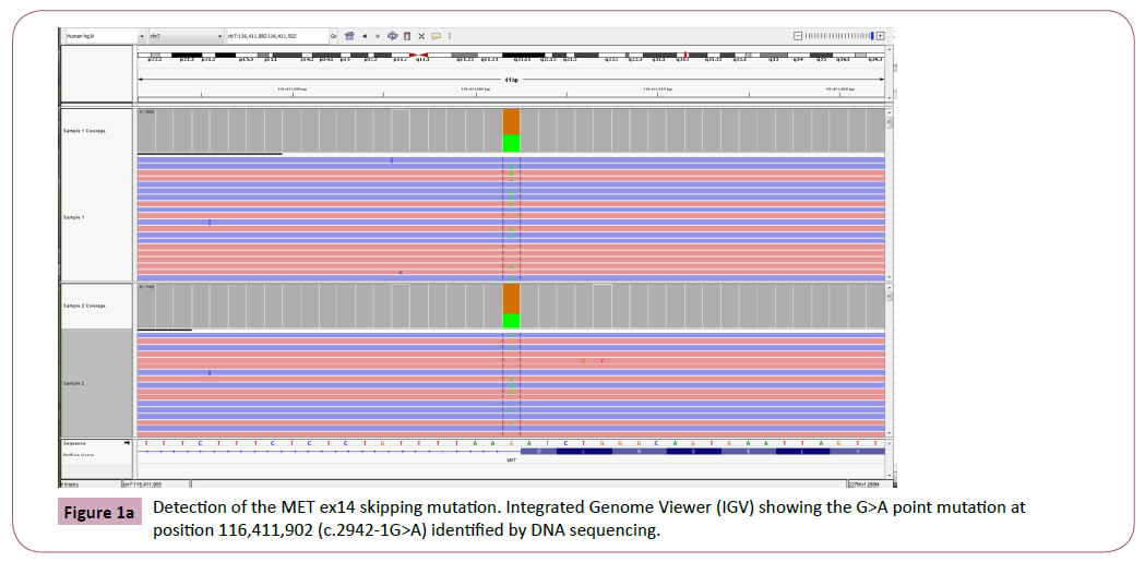 cancer-epidemiology-prevention-Integrated-Genome-Viewer